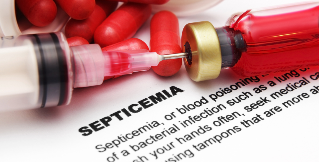 The sepsis warning signs everyone should know