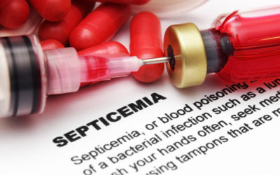 The sepsis warning signs everyone should know