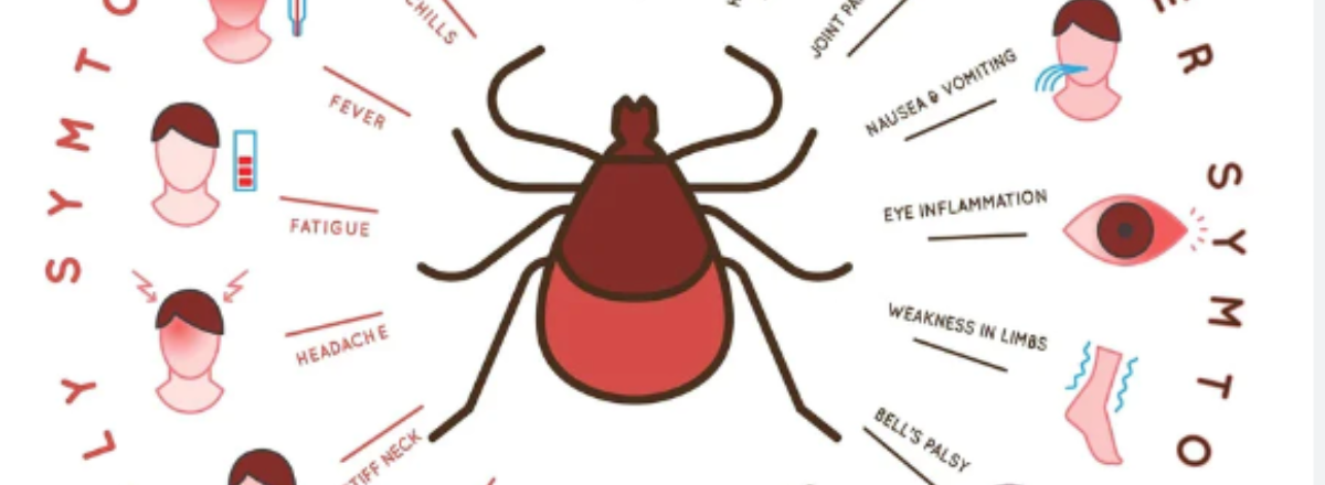 Lyme disease: signs, symptoms and how to ‘stay safe’ - ZoomDoc Health